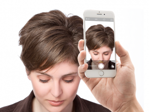Hair loss photo - Theradome