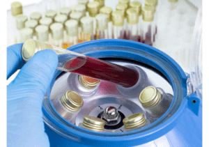 prp injections and laser therapy