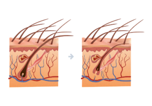 how to prevent hair loss
