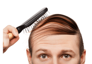 how to prevent hair loss