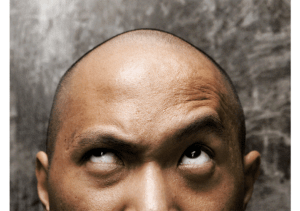 hair restoration