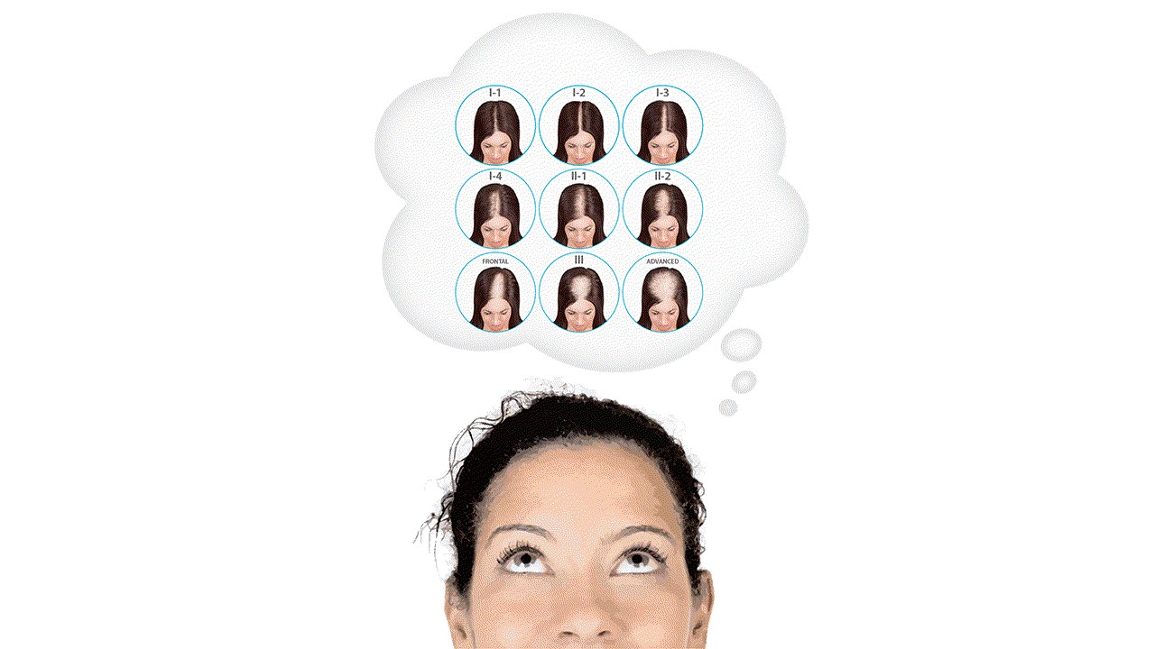 Good candidate for the theradome laser hair helmet
