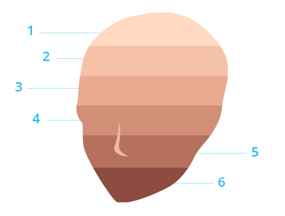 Fitzpatrick Scale | Theradome laser hair growth
