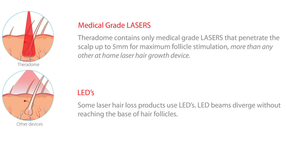 Lasers vs LEDs