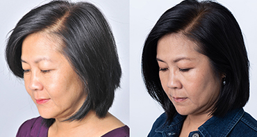 Theradome before and after user 6