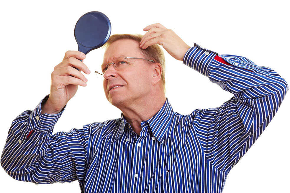 Receding Hairline